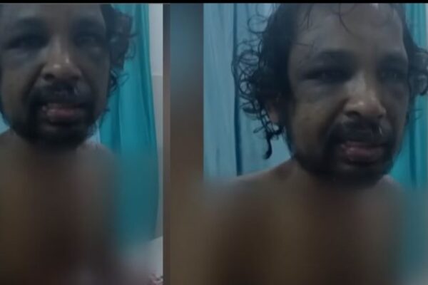 ശമ്പളം നൽകാതെ രണ്ടുവർഷമായി പീഡിപ്പിച്ചു; തിരുവനന്തപുരത്ത് തൊഴിലാളിയെ ക്രൂരമായി മർദിച്ച മില്ലുടമ അറസ്റ്റിൽ